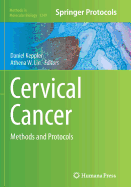 Cervical Cancer: Methods and Protocols