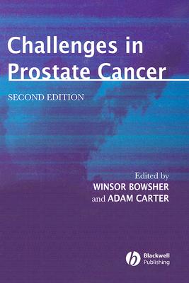 Challenges in Prostate Cancer - Bowsher, Winsor (Editor), and Carter, Adam (Editor)