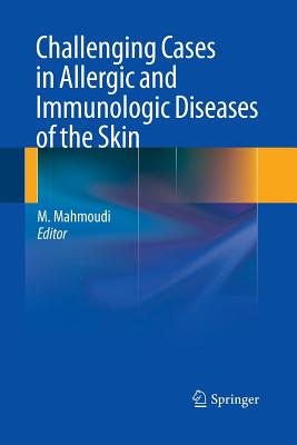 Challenging Cases in Allergic and Immunologic Diseases of the Skin - Mahmoudi, Massoud (Editor)