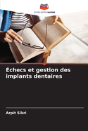 ?checs et gestion des implants dentaires