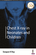 Chest X-ray in Neonates and Children