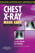 Chest X-Ray Made Easy - Corne, Jonathan