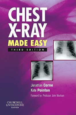 Chest X-Ray Made Easy - Corne, Jonathan, Ma, PhD, MB, Bs, Frcp, and Pointon, Kate, MRCP