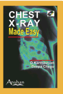 Chest X-Ray