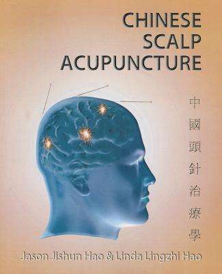 Chinese Scalp Acupuncture - Hao, Jason Jishun, and Hao, Linda Lingzhi