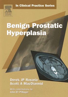 Churchill's in Clinical Practice Series: Benign Prostatic Hyperplasia - MacDiarmid, Scott A, MD, and Rosario, Derek J P, MB, Chb, Frcs, MD, and Pillinger, John E T