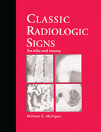 Classic Radiologic Signs: An Atlas and History