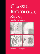 Classic Radiologic Signs: An Atlas and History