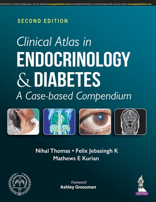 Clinical Atlas in Endocrinology and Diabetes: A Case-based Compendium - Thomas, Nihal, and Jebasingh K, Felix, and Kurian, Mathews E