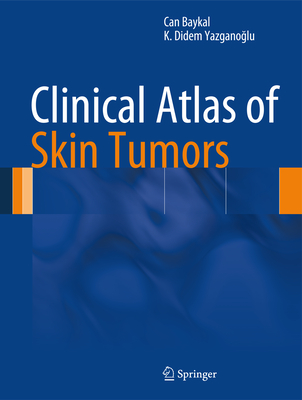 Clinical Atlas of Skin Tumors - Baykal, Can, and Yazgano lu, K Didem