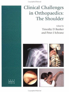 Clinical Challenges in Orthopaedics: The Shoulder - Bunker, Timothy D, and Ed, Peter J Schranz Frcs, and Schranz, Peter J