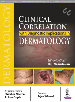 Clinical Correlation with Diagnostic Implications in Dermatology - Vasudevan, Biju