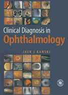 Clinical Diagnosis in Ophthalmology