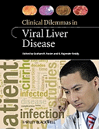 Clinical Dilemmas in Viral Liver Disease