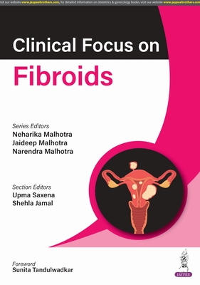 Clinical Focus on Fibroids - Malhotra, Neharika, and Malhotra, Jaideep, and Malhotra, Narendra