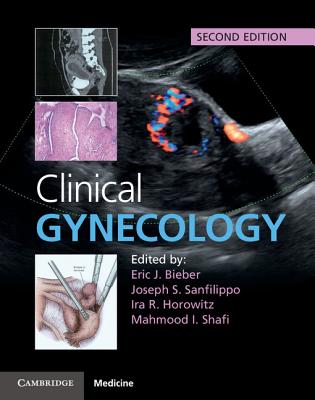 Clinical Gynecology - Bieber, Eric J, Dr., M.D. (Editor), and Sanfilippo, Joseph S (Editor), and Horowitz, Ira R (Editor)