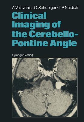 Clinical Imaging of the Cerebello-Pontine Angle - Valavanis, Anton, and Schubiger, Othmar, and Naidich, Thomas P, MD
