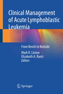 Clinical Management of Acute Lymphoblastic Leukemia: From Bench to Bedside