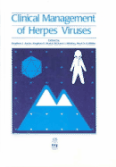 Clinical Management of Herpes Viruses