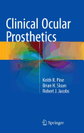 Clinical Ocular Prosthetics