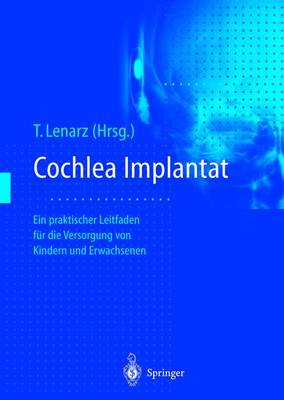 Cochlea-Implantat: Ein Praktischer Leitfaden Fur Die Versorgung Von Kindern Und Erwachsenen - Lenarz, Thomas (Editor)