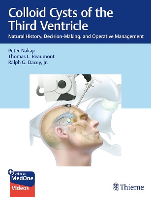 Colloid Cysts of the Third Ventricle: Natural History, Decision-Making, and Operative Management - Nakaji, Peter, and Beaumont, Thomas, and Dacey Jr, Ralph
