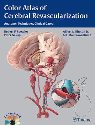 Color Atlas of Cerebral Revascularization: Anatomy, Techniques, Clinical Cases - Spetzler, Robert F, and Rhoton, Albert L, and Nakaji, Peter