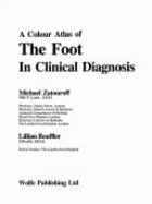 Color Atlas of Foot Conditions - Zatouroff, Michael