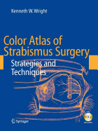 Color Atlas of Strabismus Surgery