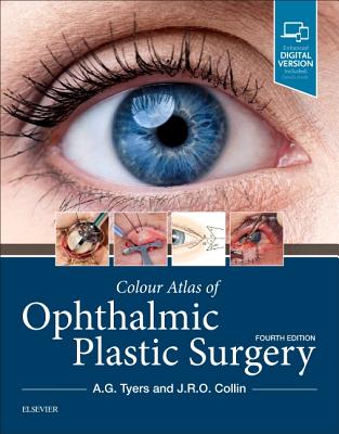 Colour Atlas of Ophthalmic Plastic Surgery - Tyers, Anthony G, and Collin, J R O, Ma, MB, Frcs, Do