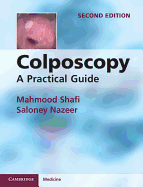 Colposcopy: A Practical Guide