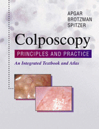 Colposcopy: Principles and Practice: An Integrated Text and Atlas