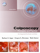 Colposcopy: Principles and Practice; An Integrated Textbook and Atlas