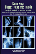 Como curar huesos rotos ms rpido. Consejos para curar fracturas de huesos: Aprenda sobre los alimentos para la curaci?n de fracturas, los tipos de fracturas y las cinco etapas de curaci?n.