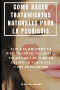 Como Hacer Tratamientos Naturales Para La Psoriasis: Alivia El Dolor de Tu Piel, Tus Uas, Tu Cabeza, Tus Axilas Y de Todo Tu Cuerpo de Todos Los Tipos de Psoriasis