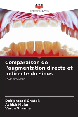 Comparaison de l'augmentation directe et indirecte du sinus - Ghatak, Debiprasad, and Mular, Ashish, and Sharma, Varun