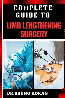 Complete Guide to Limb Lengthening Surgery: Essential Handbook To Modern Techniques, Recovery, And Best Practices For Optimal Results - Horan, Bruno, Dr.