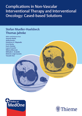 Complications in Non-Vascular Interventional Therapy and Interventional Oncology: Case-Based Solutions - Mller-Hlsbeck, Stefan (Editor), and Jahnke, Thomas (Editor)