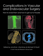 Complications in Vascular and Endovascular Surgery: How to Avoid Them and How to Get Out of Trouble