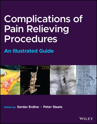 Complications of Pain-Relieving Procedures: An Illustrated Guide - Erdine, Serdar (Editor), and Staats, Peter S. (Editor)