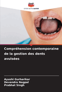 Compr?hension contemporaine de la gestion des dents avuls?es