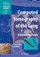 Computed Tomography of the Lung: A Pattern Approach