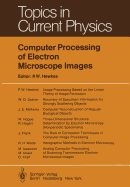 Computer Processing of Electron Microscope Images