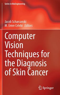 Computer Vision Techniques for the Diagnosis of Skin Cancer - Scharcanski, Jacob (Editor), and Celebi, M. Emre (Editor)