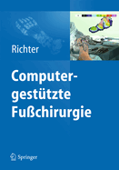 Computergest?tzte Fu?chirurgie: Intraoperative 3-D-Rntgenbildgebung, Navigation, Intraoperative Pedographie