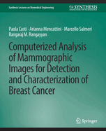 Computerized Analysis of Mammographic Images for Detection and Characterization of Breast Cancer