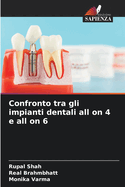 Confronto tra gli impianti dentali all on 4 e all on 6