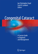 Congenital Cataract: A Concise Guide to Diagnosis and Management