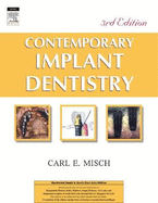 Contemporary Implant Dentistry