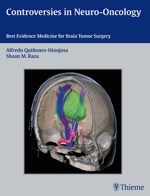 Controversies in Neuro-Oncology: Best Evidence Medicine for Brain Tumor Surgery - Quinones-Hinojosa, Alfredo, Doctor (Editor), and Raza, Shaan M (Editor), and Laws, Edward R (Editor)
